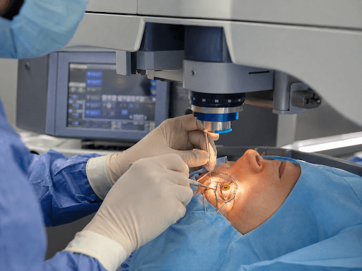 Patient undergoing LASIK eye surgery while an ophthalmic surgeon uses a laser system and surgical instruments to reshape the cornea.